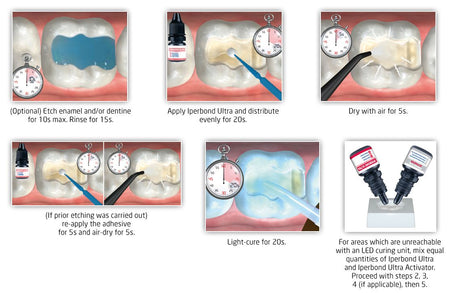 Itena Iperbond Max Universal Adhesive 5 ml