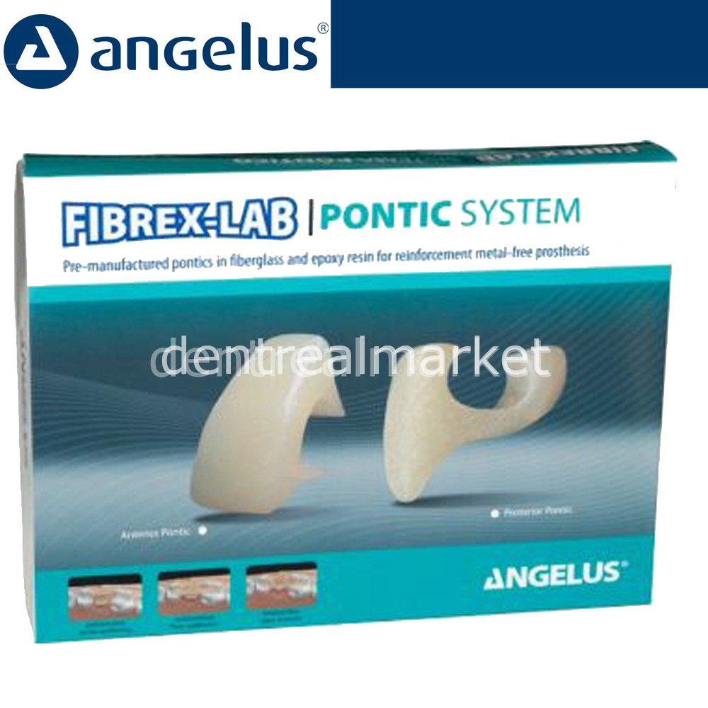 Angelus Fibrex-Lab Pontic System Kit