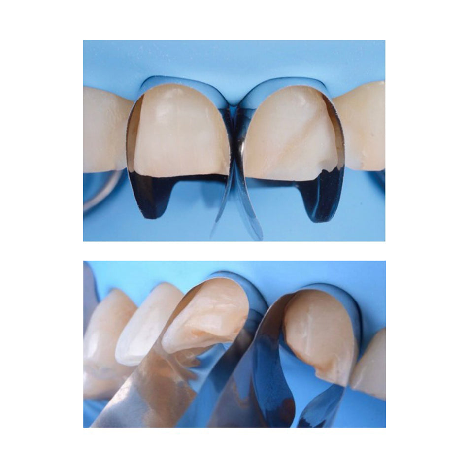 Palodent V3 Matrix - Ring 