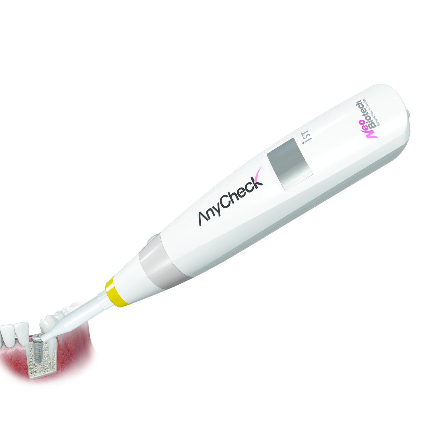 Neobiotech - Anycheck Osstell Device - Dental Implant Stabilty Tester ...
