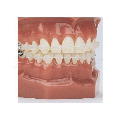 American Orthodontics EverWhite NiTi Cosmetic Rectangular Archwire