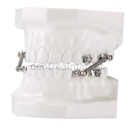 Dynaflex CS-2000 10 Patient Kit