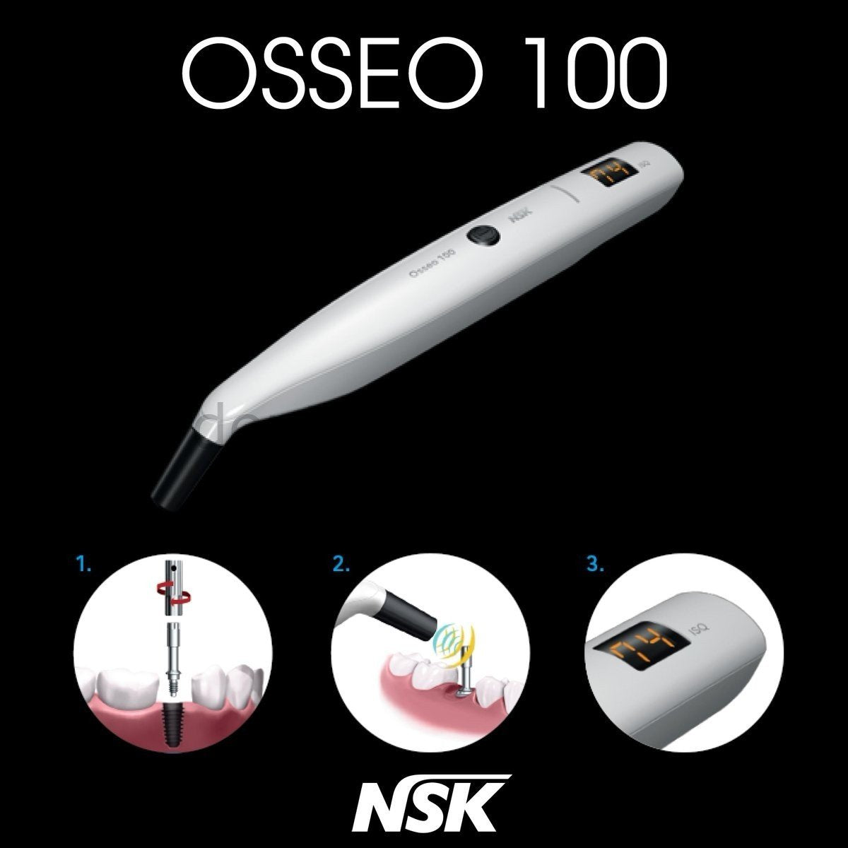 NSK Osseo 100 Implant Stability Meter — Osseointegration Monitor