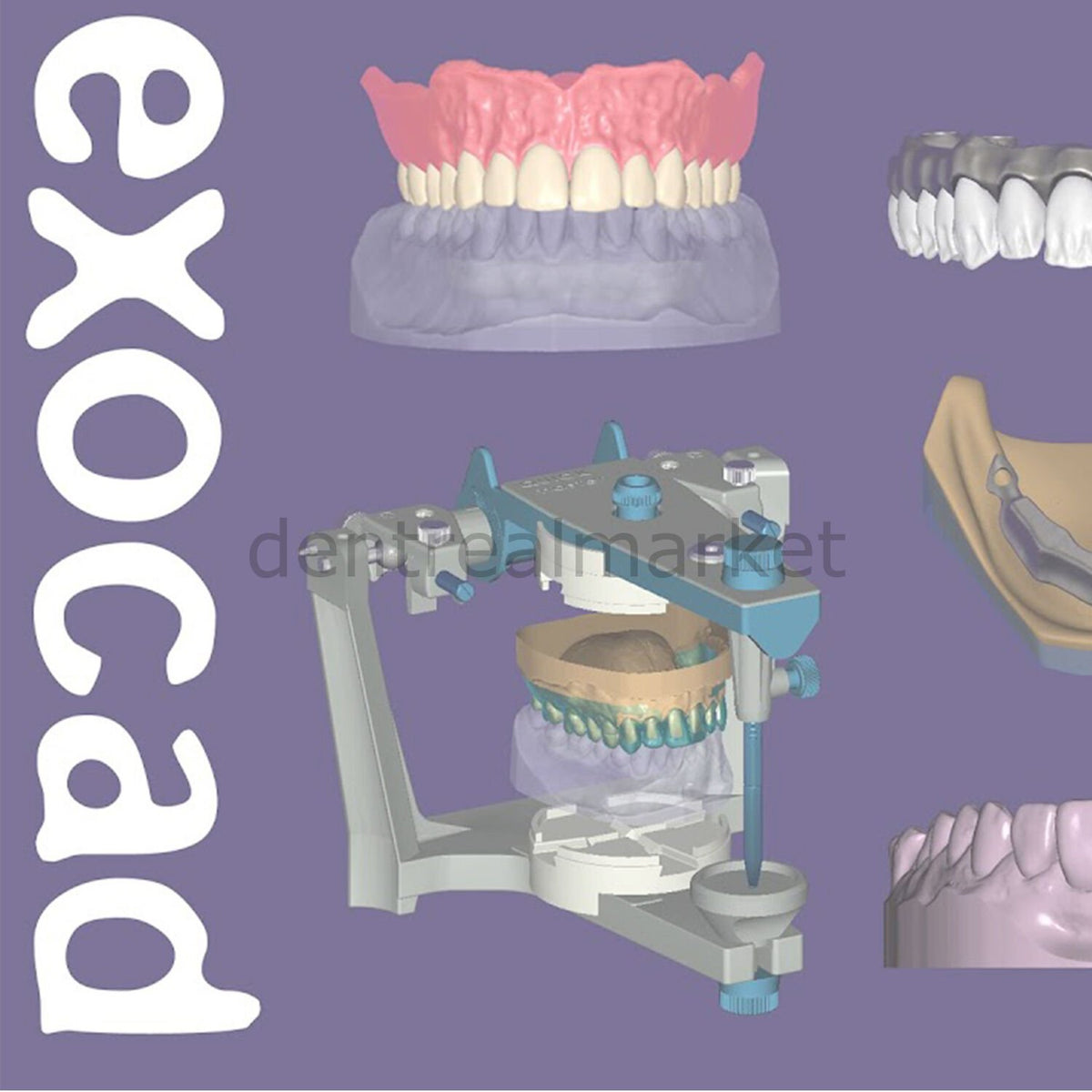 Exocad 3D Dental Design Software — Ultimate Lab Bundle