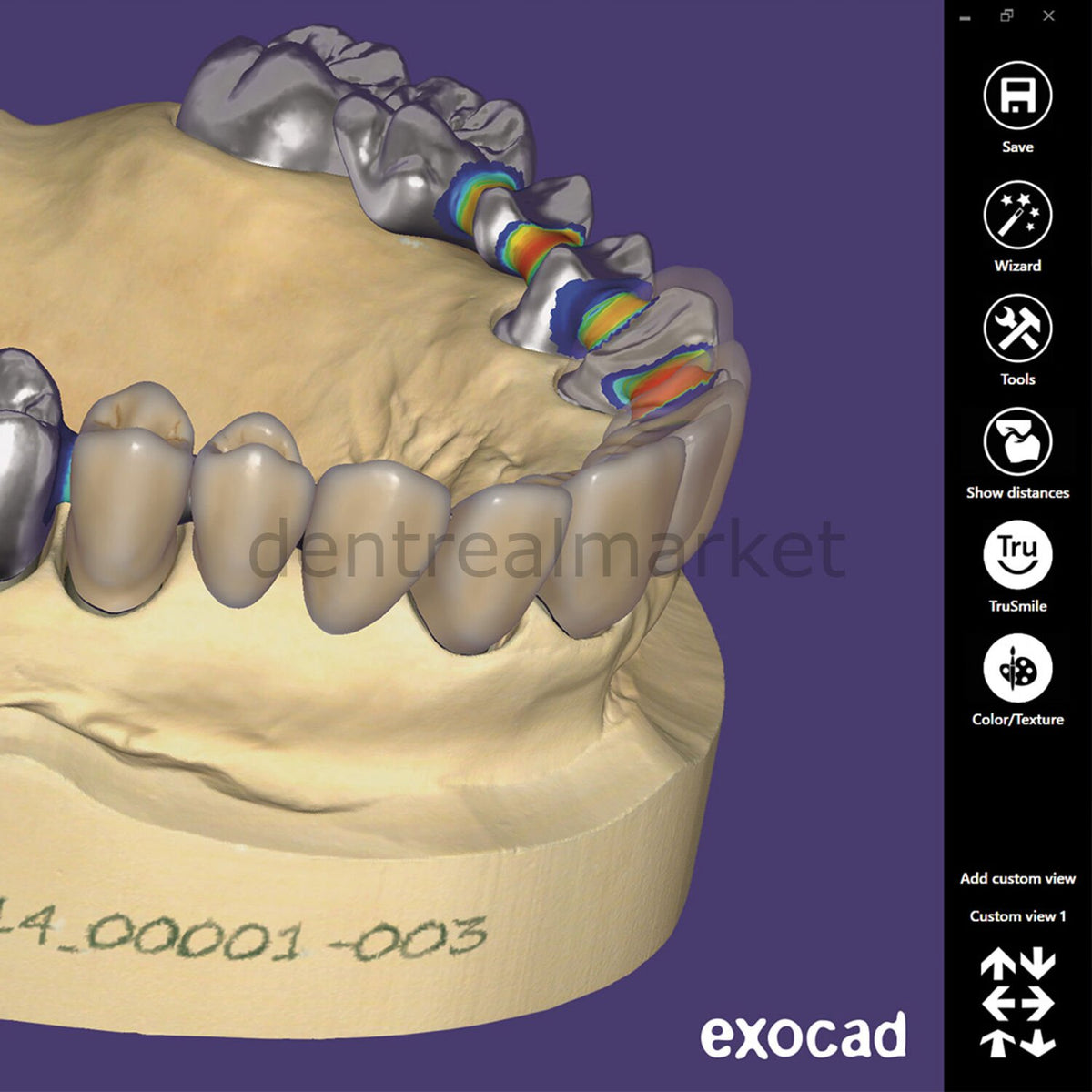 Exocad 3D Dental Design Software — Ultimate Lab Bundle