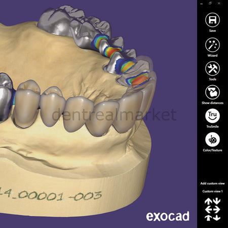 Exocad 3D Dental Design Software — Ultimate Lab Bundle