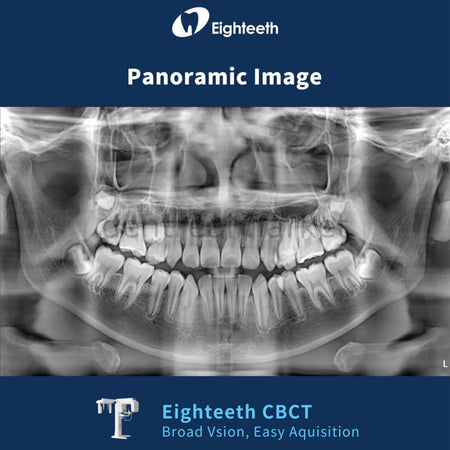 Eighteeth FinScan F350 CBCT and Panoramic X-ray System