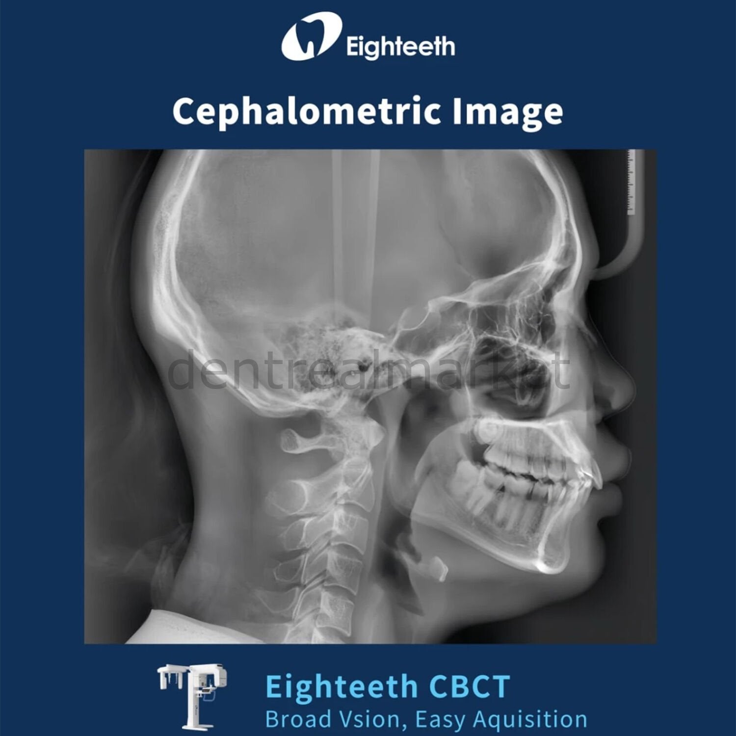 Eighteeth FinScan F350 CBCT with Cephalometric and Panoramic System