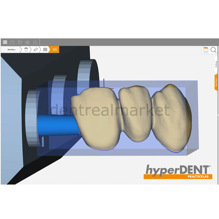 Hyperdent HyperDENT CAM Software for Dental Milling Machines