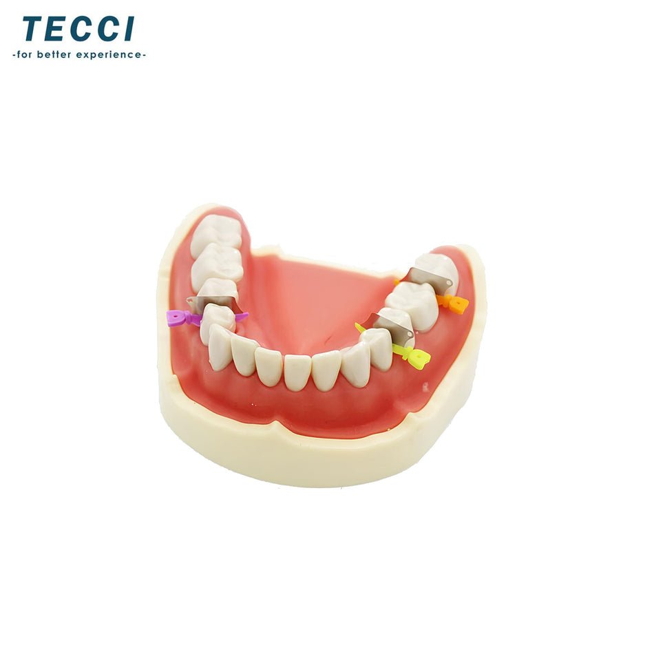 Palodent V3 Matrix - Ring 