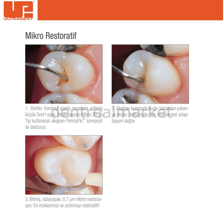 Ultradent PermaFlo Flow Dentin Opaquer Flowable Composite Refill