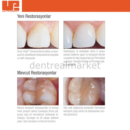 Ultradent PermaSeal Mini Kit - Composite Surface Sealant