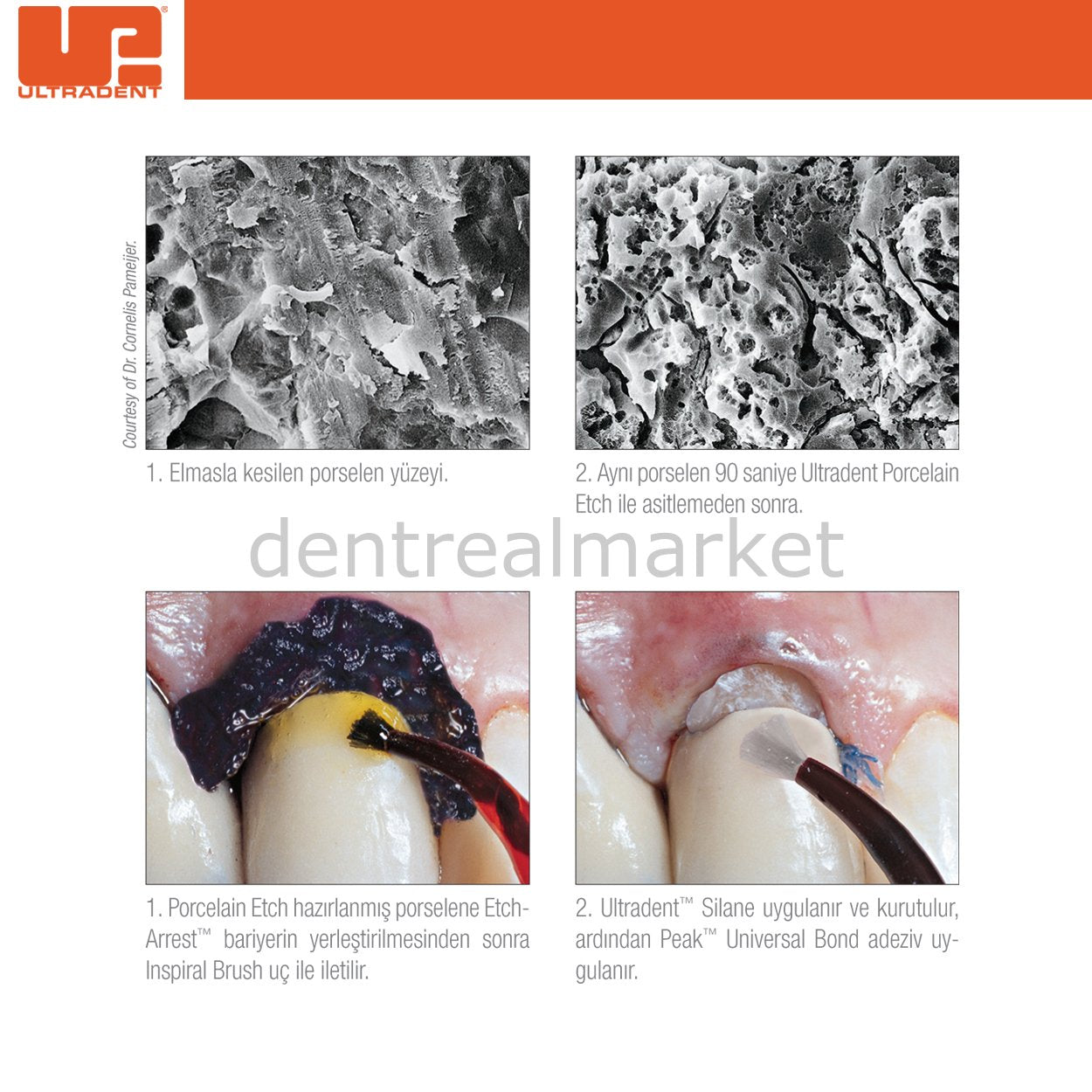 Ultradent Porcelain Etch + Silane Kit