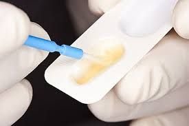 DMG Flairesse Varnish 35 x 0.4 ml Fluoride Protective Varnish