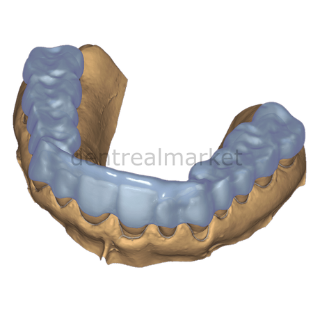Exocad ChairsideCAD Bite Splint Module