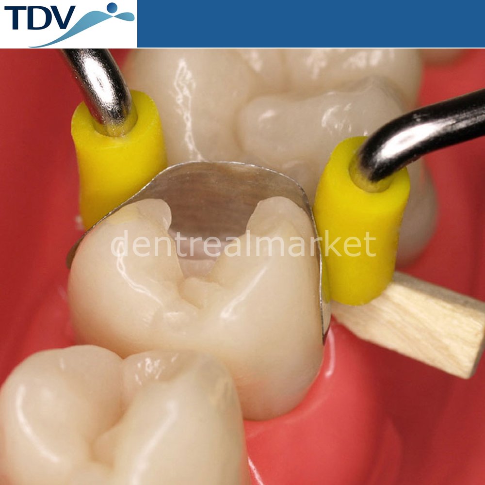 Tdv Dental Unimatrix Matrix Mini Set