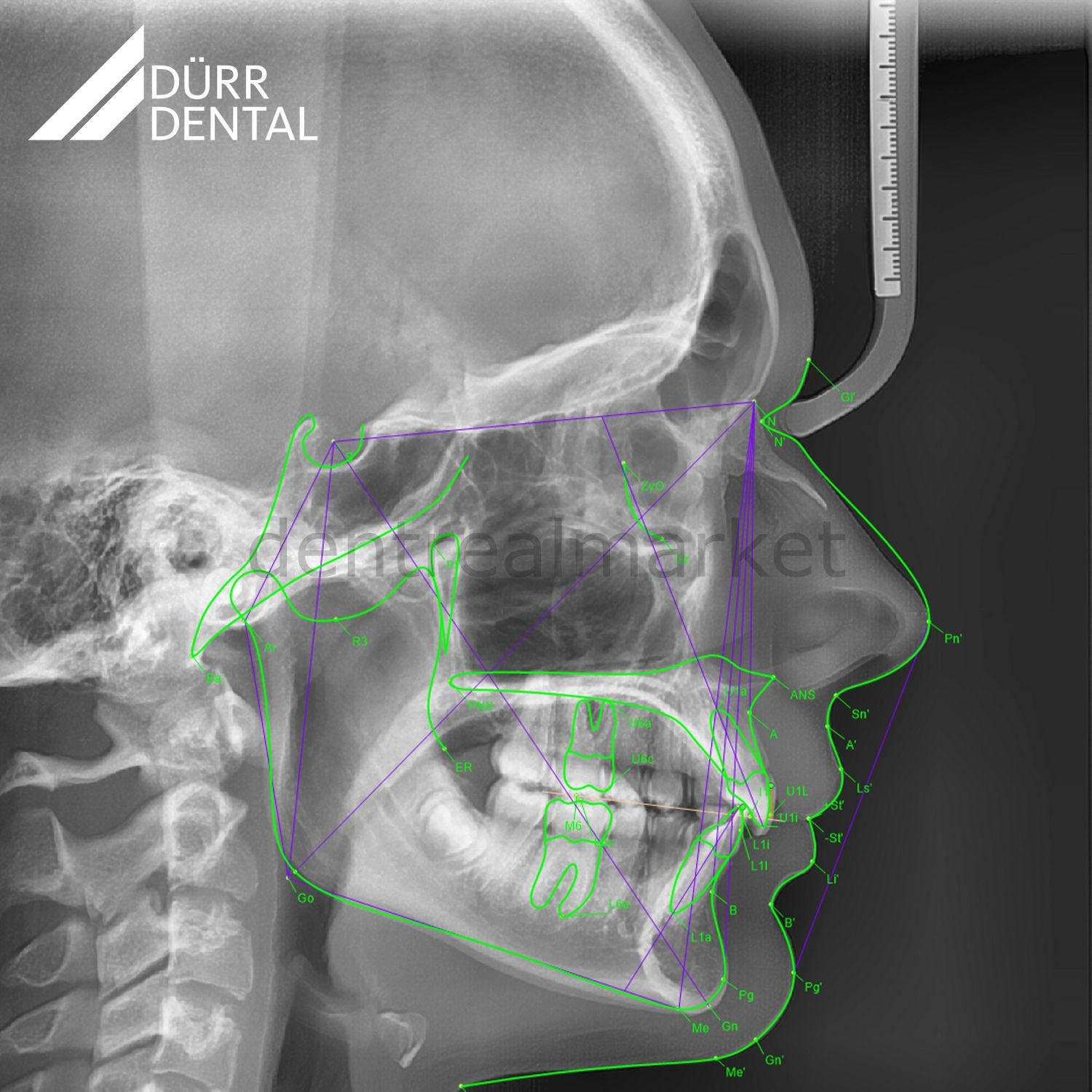 Durr Dental VistaPano S Panoramic + Ceph X-Ray
