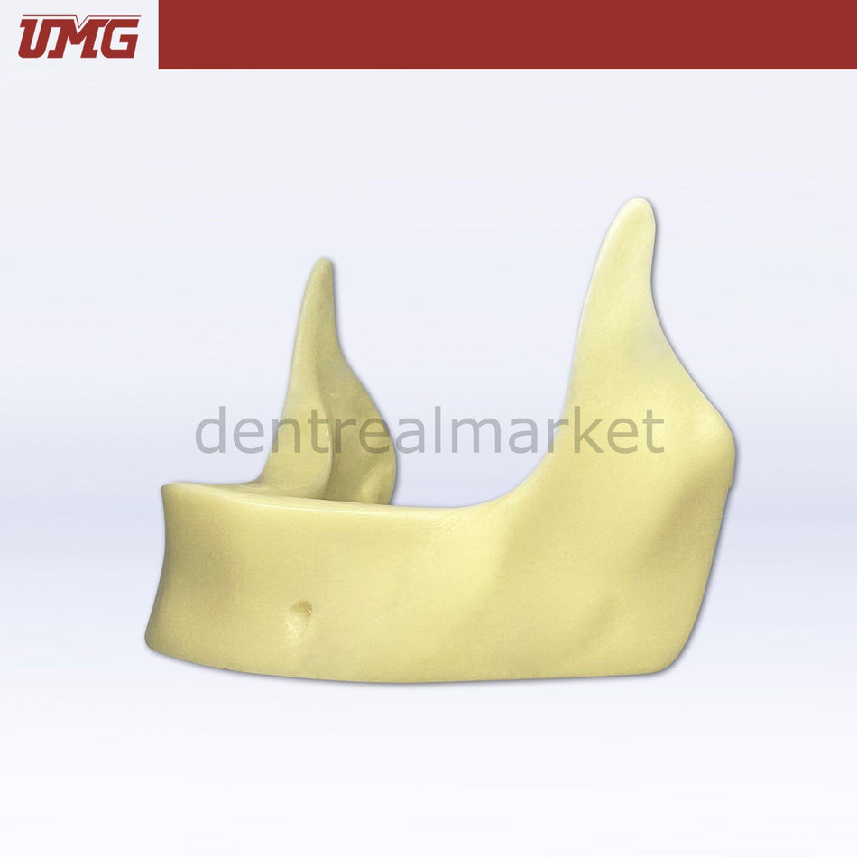 DentrealStore - Umg Dental Umg Model Implant Application Training Model - UM-Z2025