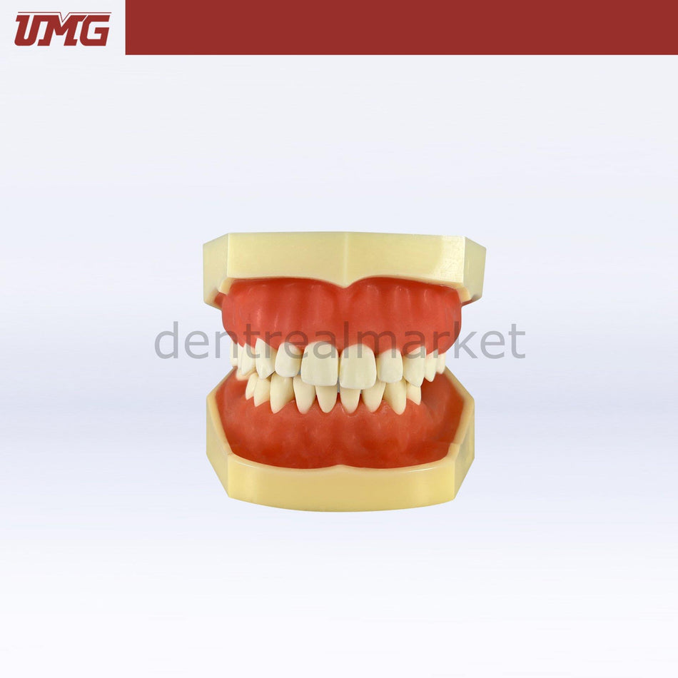 DentrealStore - Umg Dental Umg Model Implant Training Model Upper-Lower Jaw - UM-2030