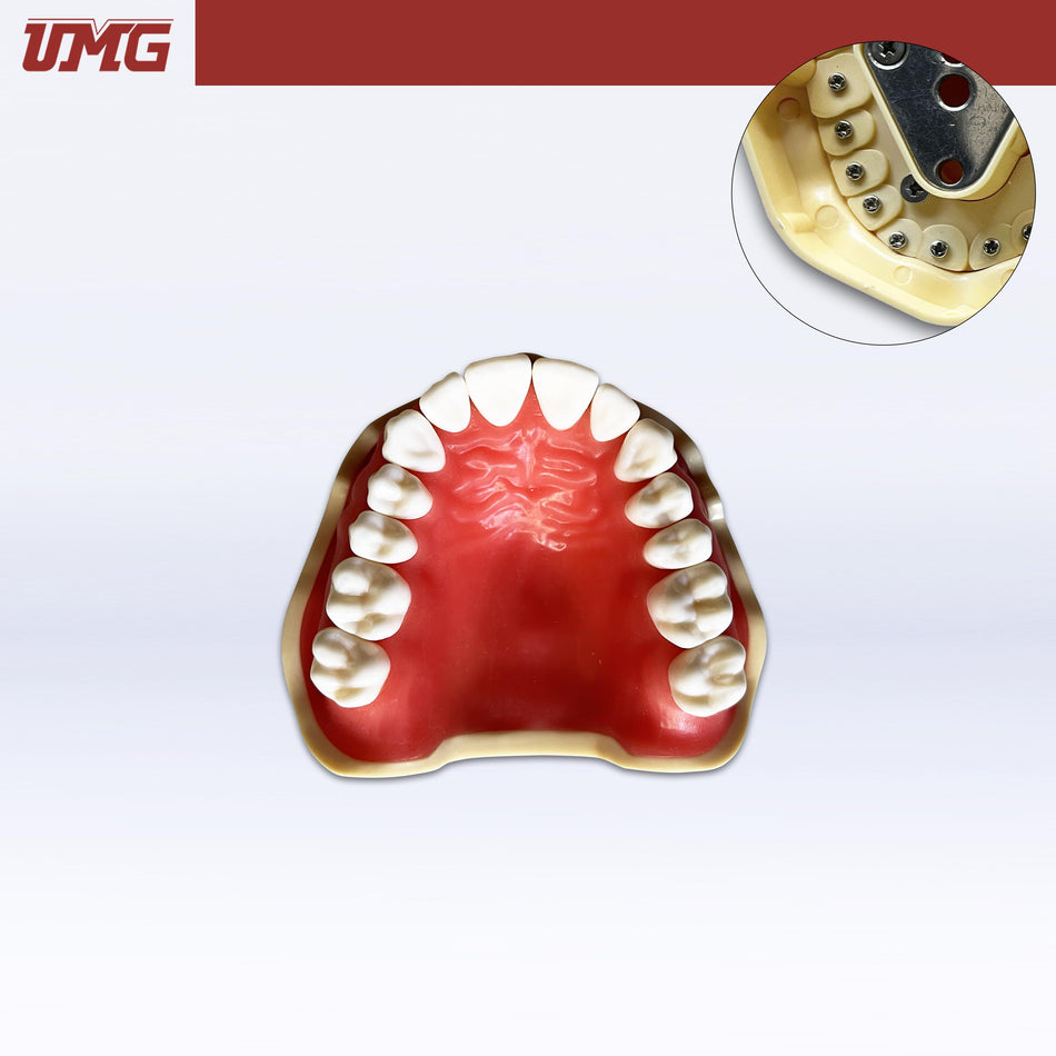 DentrealStore - Umg Dental Umg Model Removable Teeth Training Model Upper - Frasaco Compatible - UM-A2F